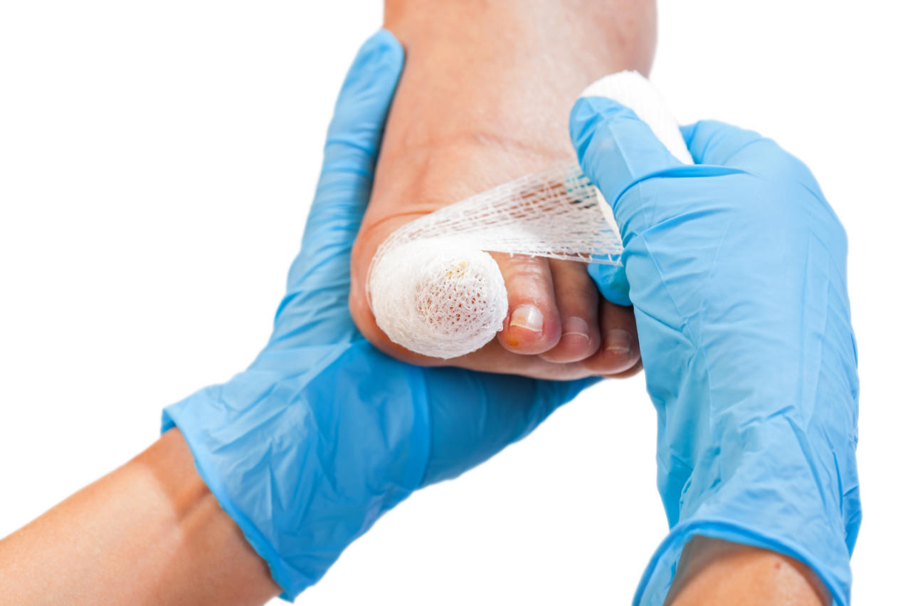 bandaged toe