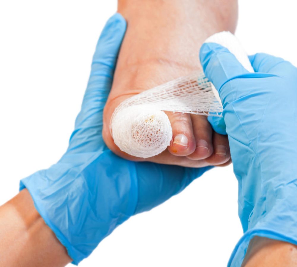 bandaged toe